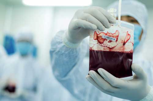 输脐带血干细胞副作用