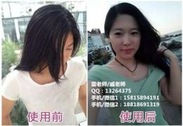 广州怎样让白发变黑发 提供专业满意度保证