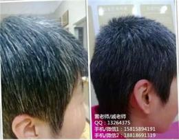 广州白发变黑发最好的方法 纯药制剂