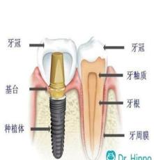 广州牙齿美白套餐-河马医生牙医平台