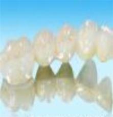 同生义齿 厂家直销 IPS e ,max铸瓷贴面 普泰德个性化医疗义齿