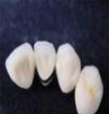 同声义齿 厂家直销 爱尔创氧化锆 普泰德高强度及密合度内冠义齿