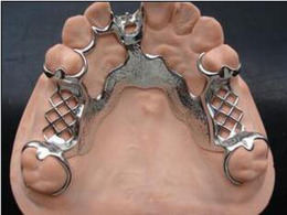 纯钛假牙钢托义齿焊接
