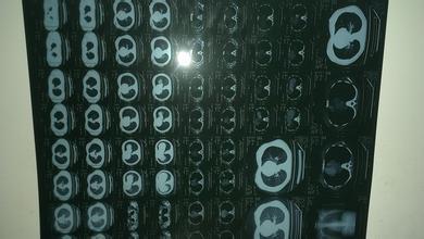 沈阳回收CT胶片印刷菲林片探伤X光片回收