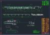 DSJ型伸缩带式输送机全套cad图纸
