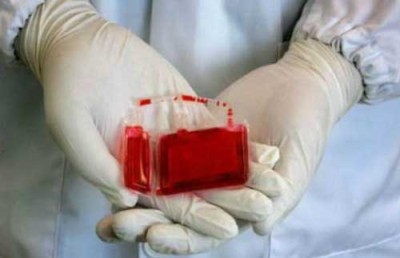 贵州造血干细胞再生