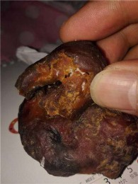 大庆鸡宝怎么鉴定