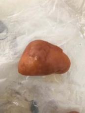 永州雞寶收購