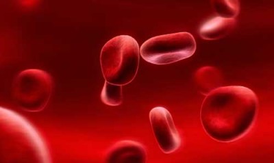 造血干细胞移植主要适用于
