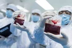 南京威海干细胞移植