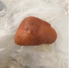 汕头市辖区鸡宝现金收购