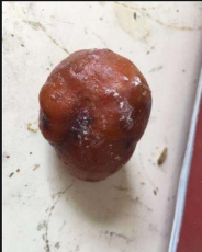 天津環城四區鴨寶售賣中心電話