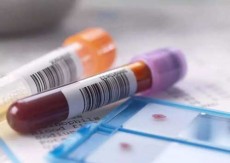 脐带血cd34细胞标准是多少