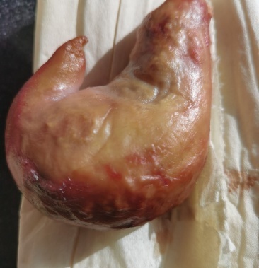 保定猪宝鉴定价格行情