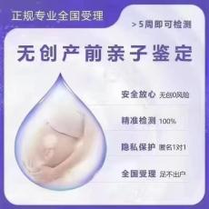 济南胎儿亲子鉴定怎么做